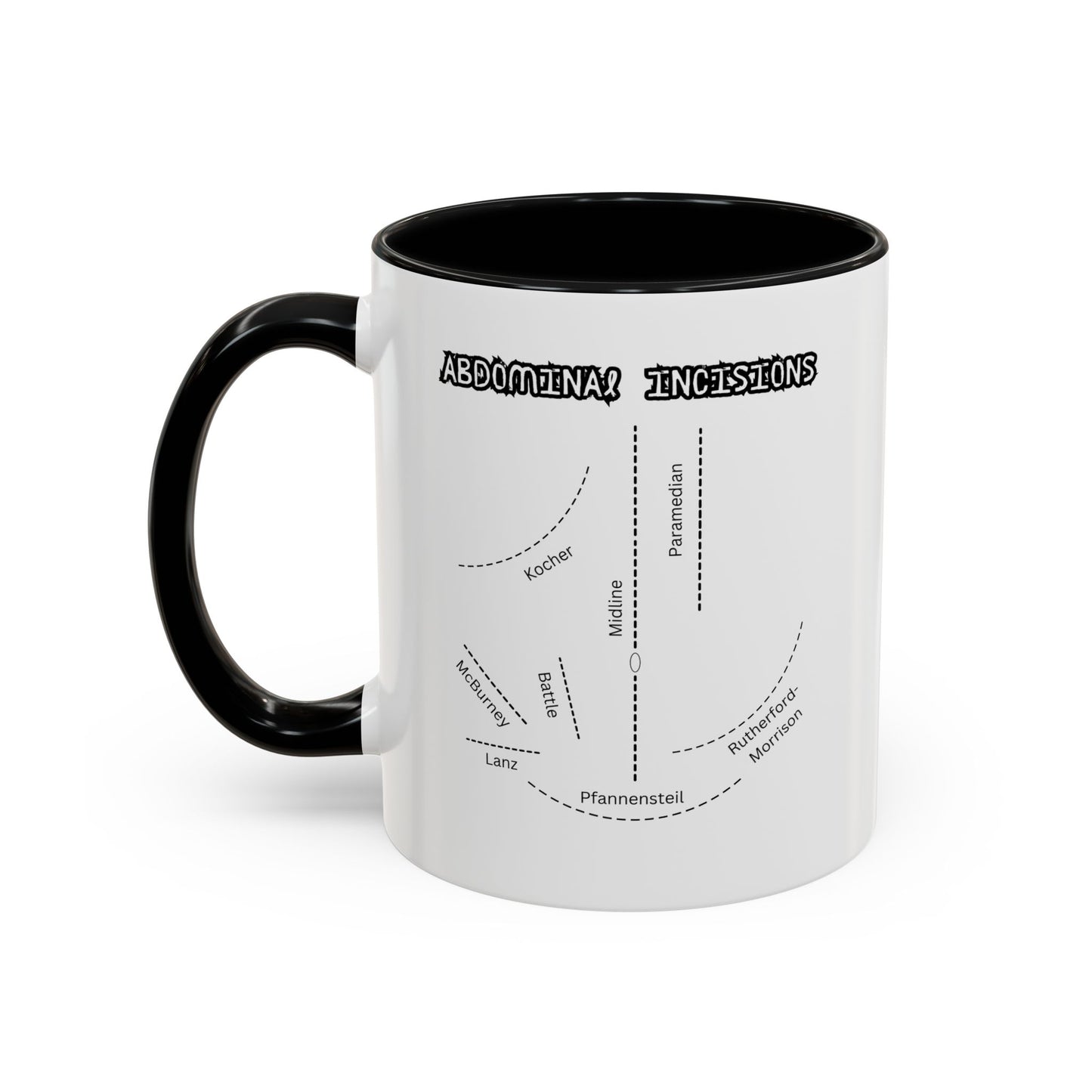Abdominal Incisions Coffee Mug – Coffee for General Surgeons